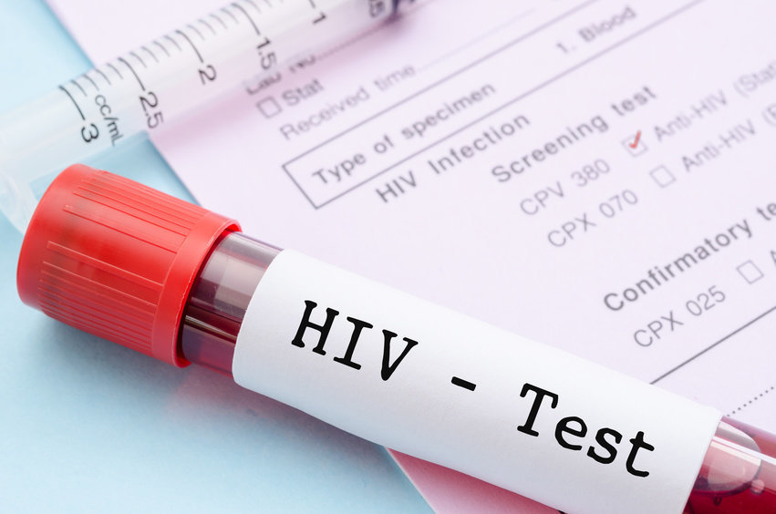 Diminuiscono i casi di Hiv in Italia, ma è Sos per i più giovani