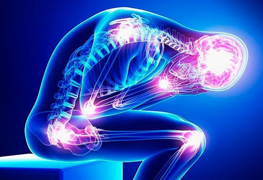 Fibromialgia: per liberare milioni di ‘‘malati immaginari’’