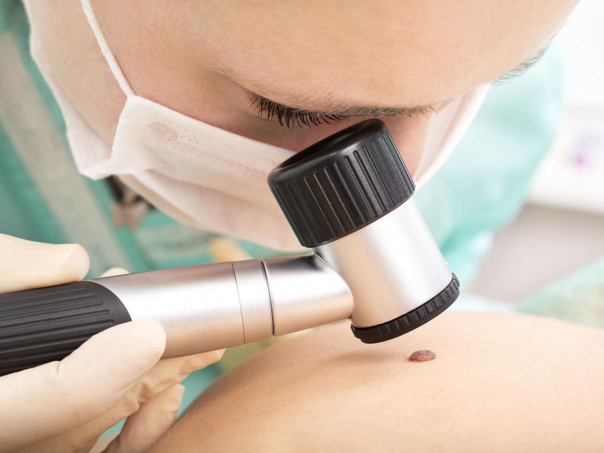 L’Opinione risponde: Epiluminescenza