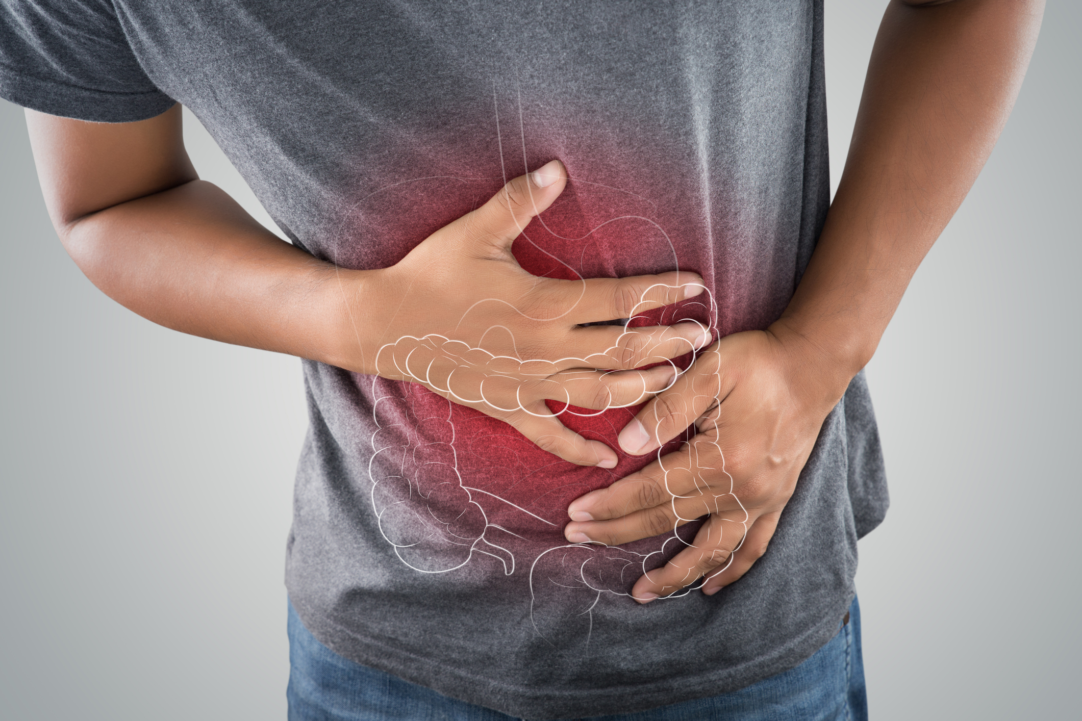 L’Opinione Risponde: la diverticolosi (video)