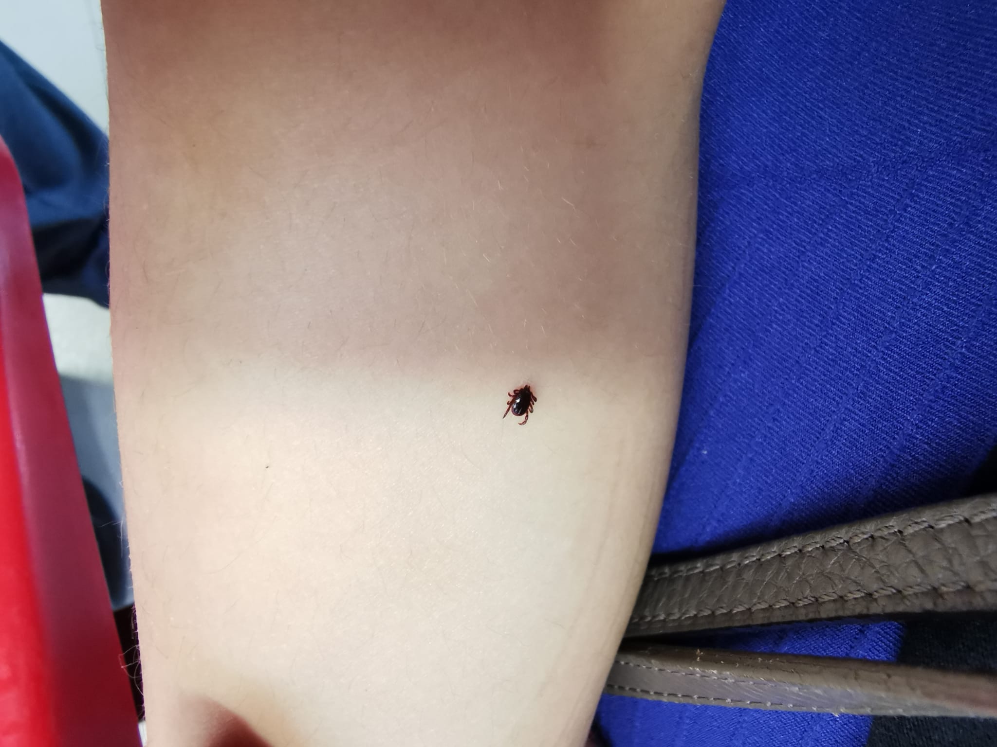 Erba alta nel nido, bimba punta da una zecca