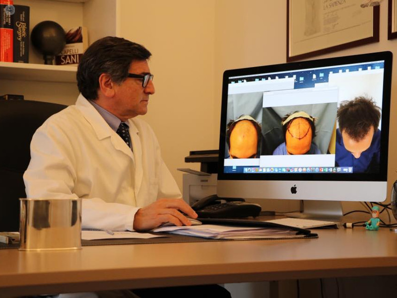 Professor Toscani: i rischi dei viaggi low cost per il trapianto di capelli (video)