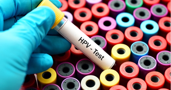 Prevenzione Hpv: il vaccino prima di fare sesso (Video)