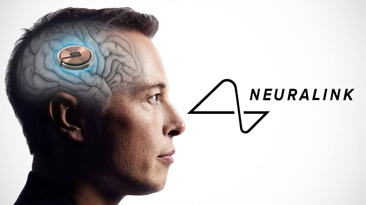 Elon Musk installa il primo chip cerebrale su un uomo