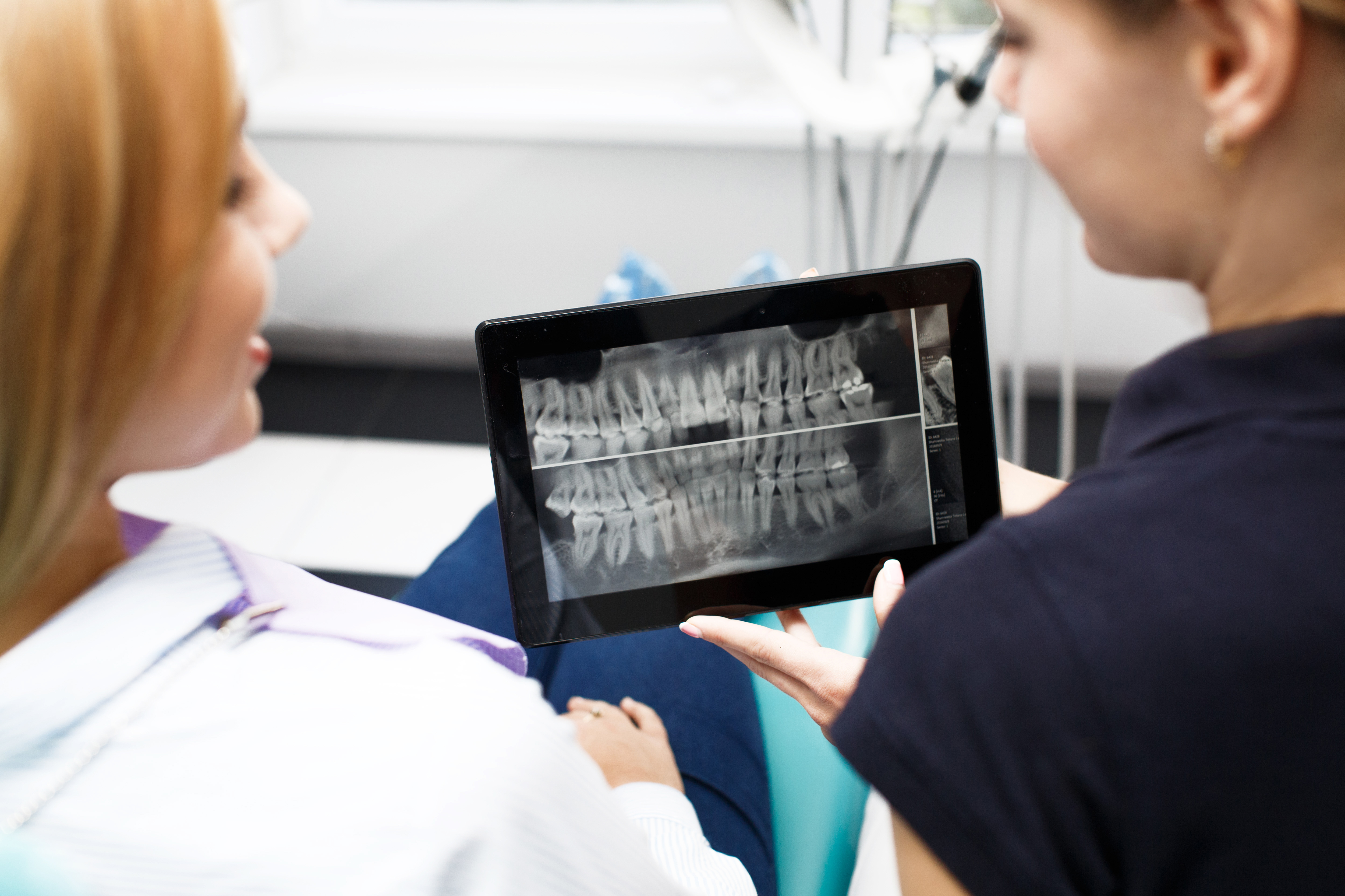 Software CAD dentale: come sta trasformando la progettazione protesica